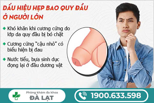 Hình ảnh minh họa